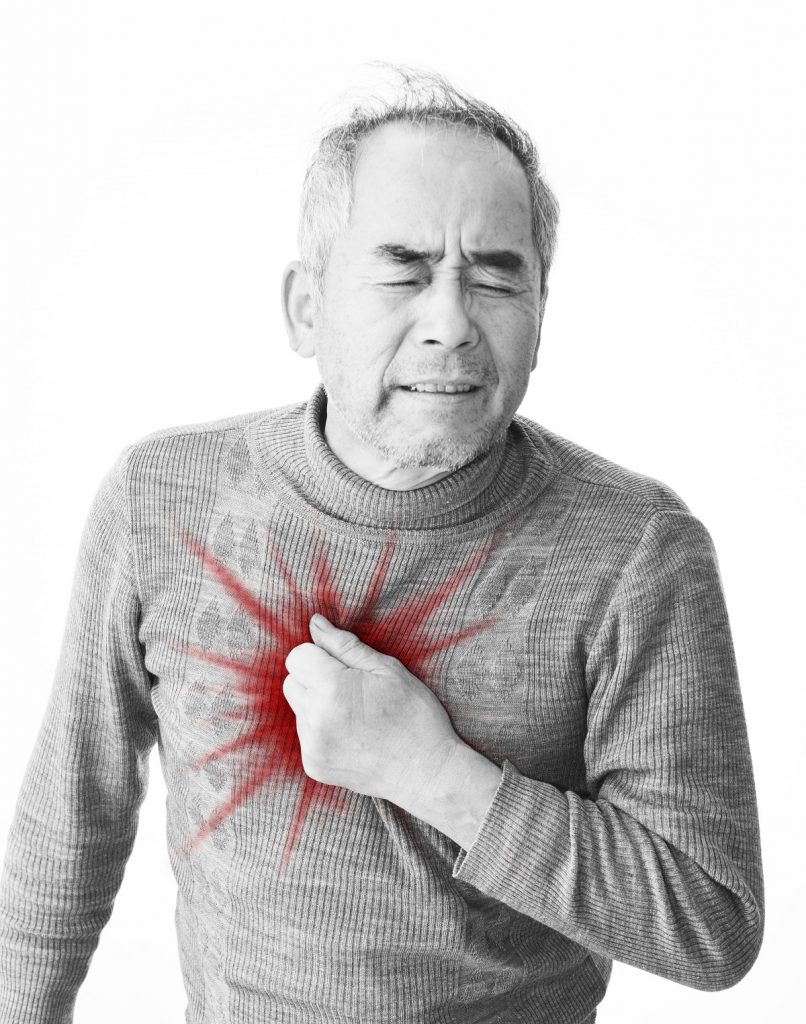 Dissection Aortique Homme Asiatique