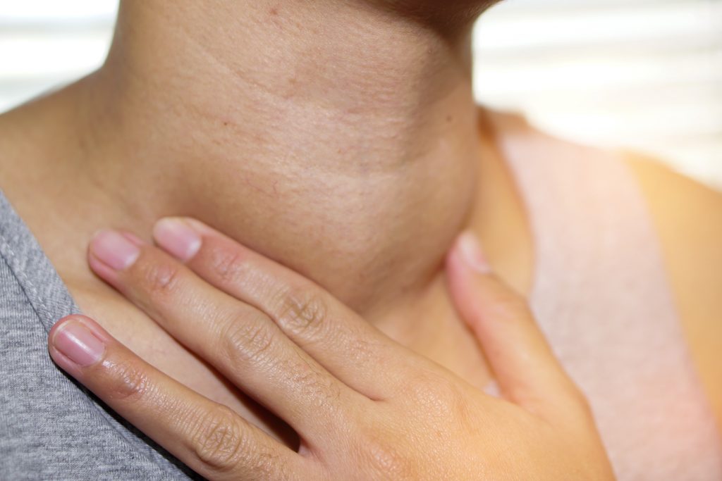 Goitre Thyroïdien : cou femme
