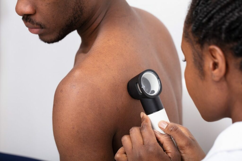 Examen dermatologique chez l'homme