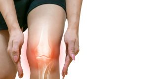 Ruptures des ligaments des genoux : femme