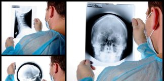 traumatisme cranio-faciale :radiologie