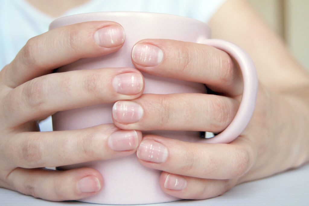 Tâche blanche sur des ongles