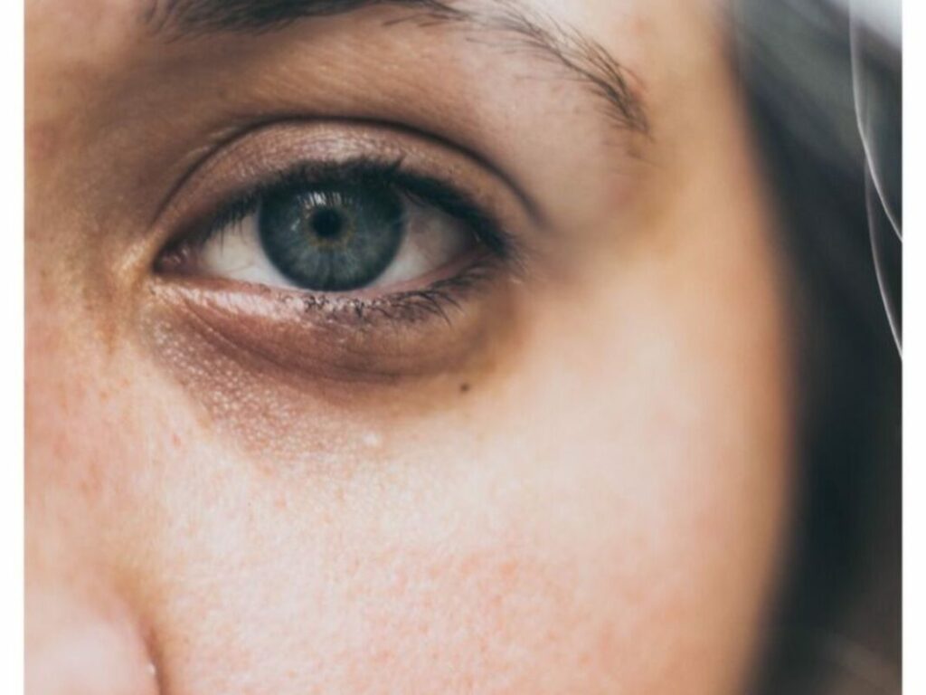 Pourquoi a t on des cernes quand on est fatigués