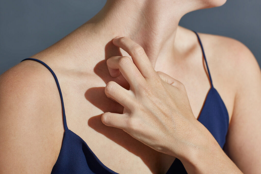 signe allergie soleil