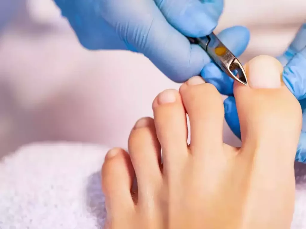 Erreurs à ne pas faire quand coupe ongles pieds