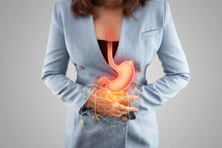 Que manger en cas de reflux gastriques ?