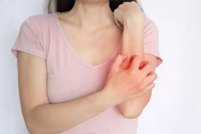 La gale fait son retour dans des écoles et des Ehpad