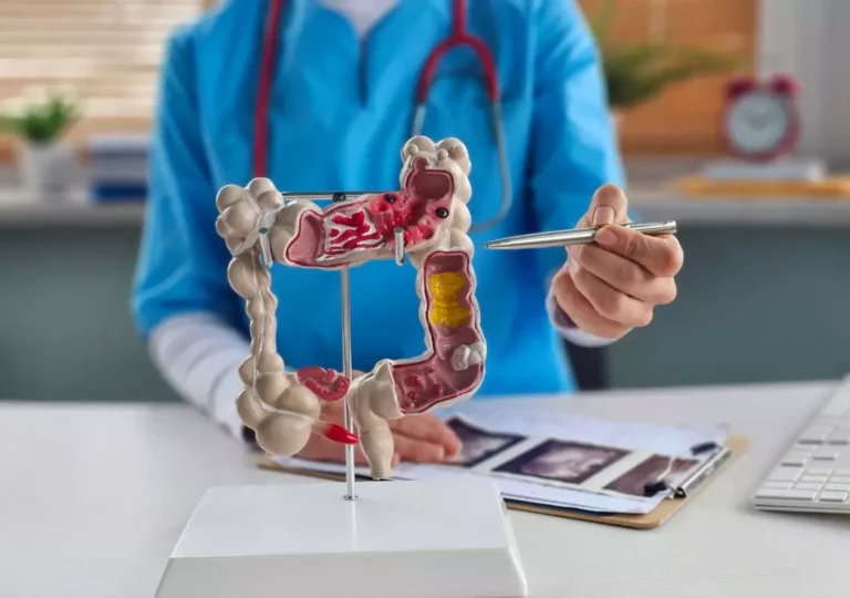 Ignoré par des millions de Français, ce test simple pourrait éviter des milliers de décès cancer du colon