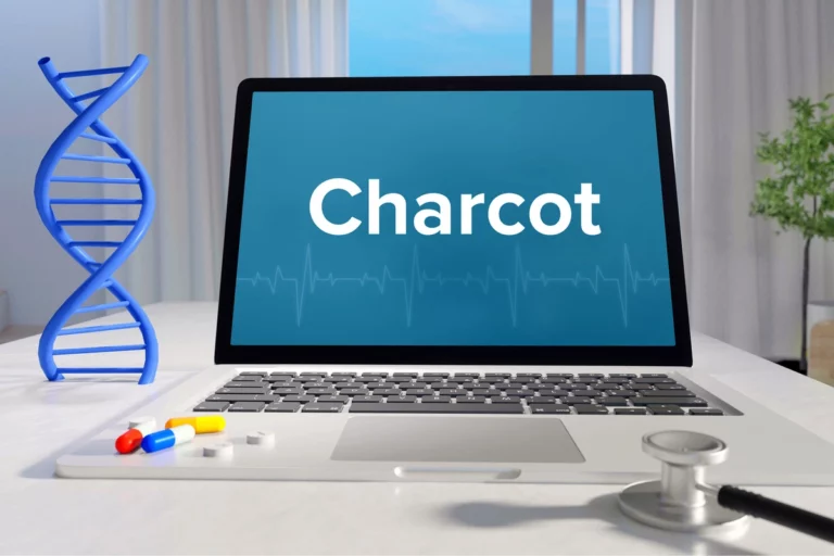 Maladie de Charcot : ces symptômes discrets à ne pas négliger maladie de charcot